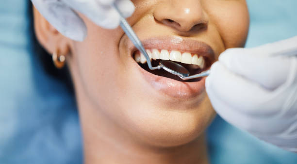 Best Emergency Dental Care for Sports Injuries in Spanish Lake, MO